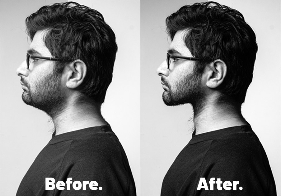 how to remove double chin photoshop